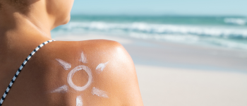 Riesgos de tomar el sol