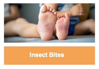 Insect Bites